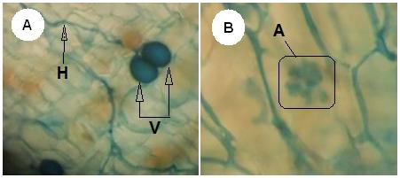 mycorhizes, mycorhization